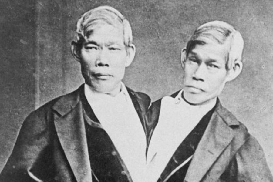 I gemelli siamesi più famosi di sempre