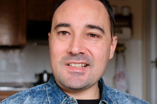 Nicola, 36enne senza lavoro perchè invalido: “Mi hanno aperto la testa ma posso lavorare”