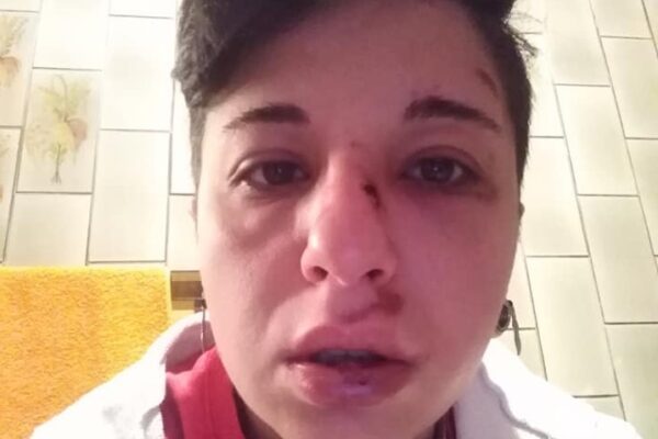 Giulia aggredita perchè lesbica: “Denuncio perchè non accada mai più”