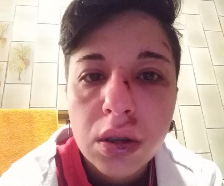 Giulia aggredita perchè lesbica: “Denuncio perchè non accada mai più”