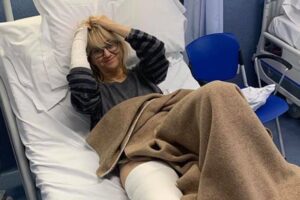 Luciana Littizzetto operata alla gamba ironizza: “Sto bene col gessato?”