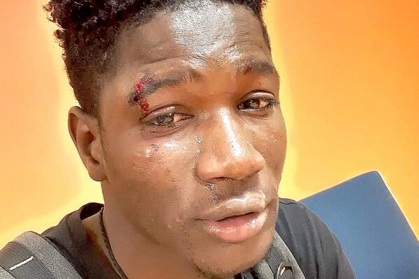 Ragazzo originario del Senegal picchiato a Palermo non ci sta: “E’ una città bellissima, accogliente e antirazzista”