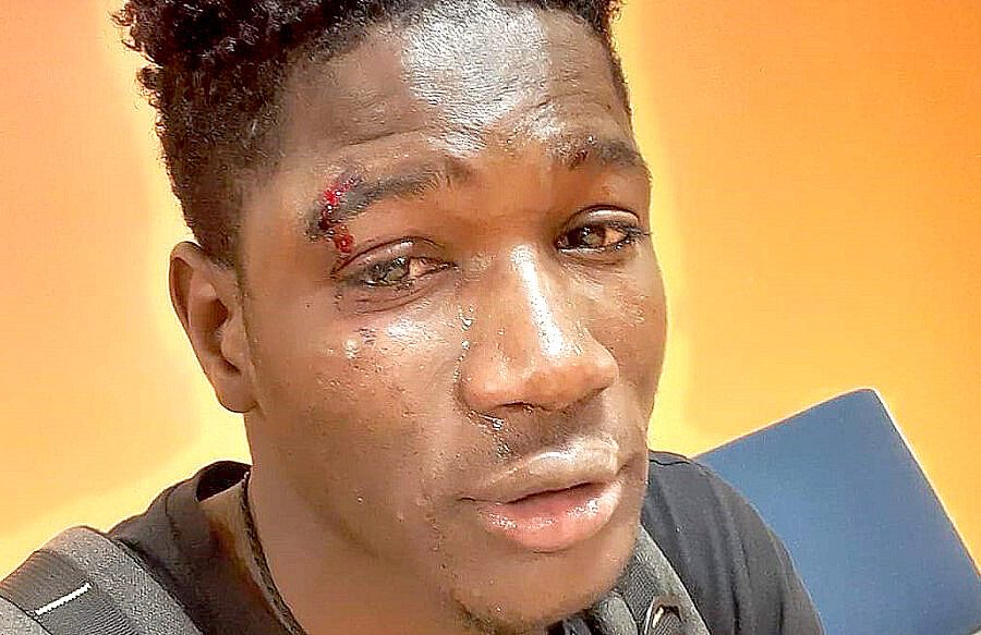 Ragazzo originario del Senegal picchiato a Palermo non ci sta: “E’ una città bellissima, accogliente e antirazzista”