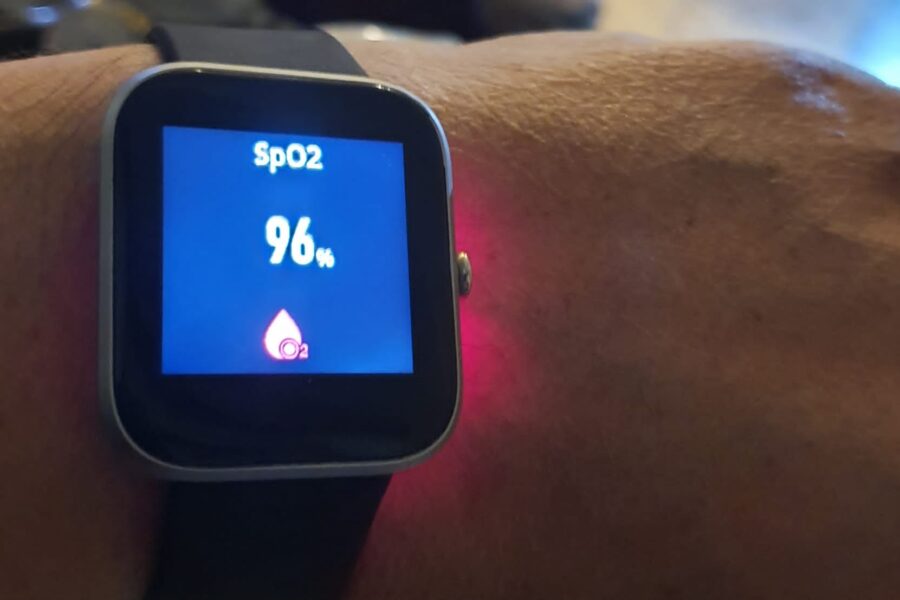 Covid 19, il Pascale assiste i pazienti a casa attraverso un orologio