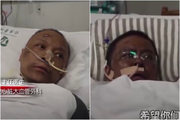Contagiati di Covid in coma si risvegliano neri, l’incredibile caso di due cinesi