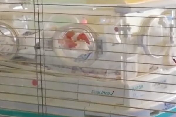 “Muove il piedino”, neonata prematura guarisce dal coronavirus: “Soddisfazione unica”