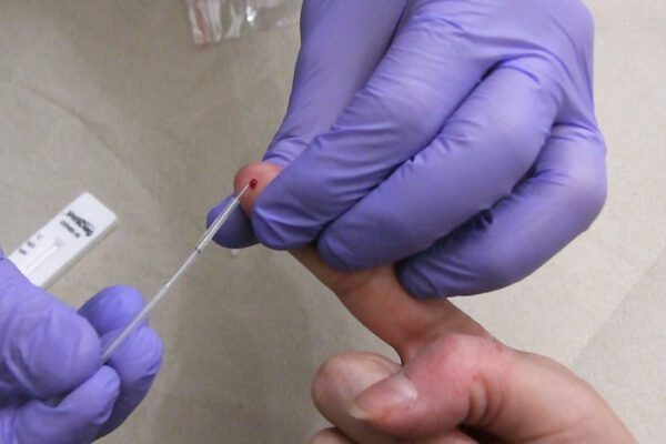 Il video-tutorial: Come farsi il test sierologico