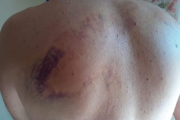 Detenuti positivi in carcere, proteste e violenze: “E’ mio dovere mostrare questa foto”