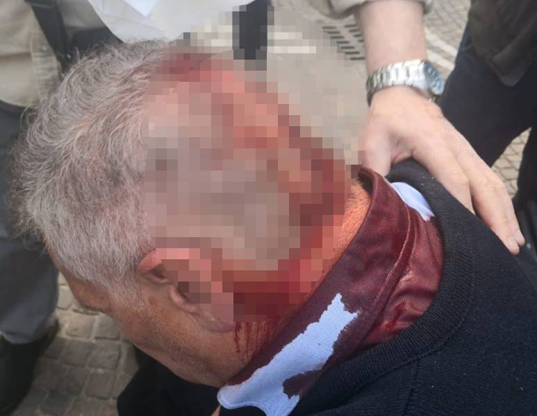 Il vigile interviene per sedare la rissa: pestato dalla baby gang