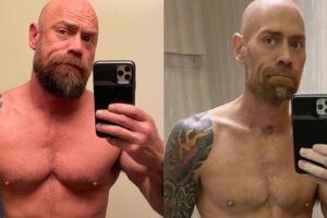 Perde più di 20 chili in un mese: gli effetti del covid sull’infermiere