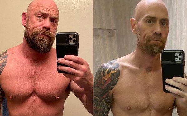 Perde più di 20 chili in un mese: gli effetti del covid sull’infermiere