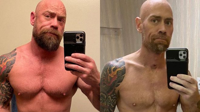 Perde più di 20 chili in un mese: gli effetti del covid sull’infermiere