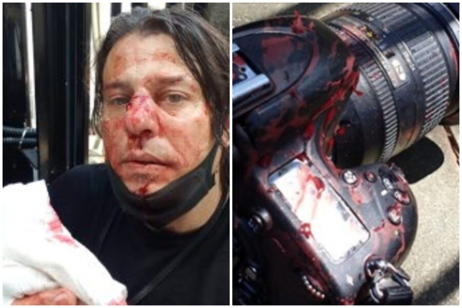 Londra, fotoreporter italiano picchiato da “un gruppo di estrema destra”