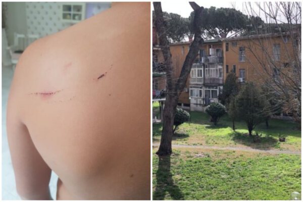 Sparano con le pistole ad acqua, bimbo reagisce e viene frustato. La mamma: “Basta bullismo”