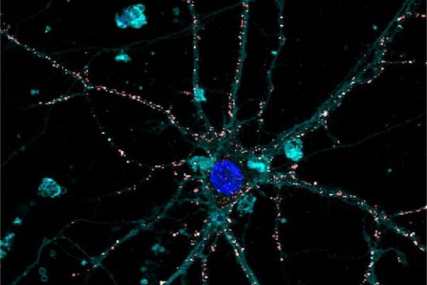 Modello sperimentale di retina liquida_Benfenati_Lanzani
RIPRODUZIONE RISERVATA