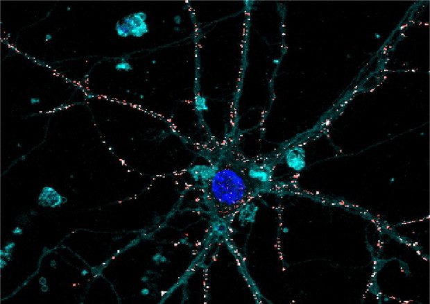 Modello sperimentale di retina liquida_Benfenati_Lanzani
RIPRODUZIONE RISERVATA