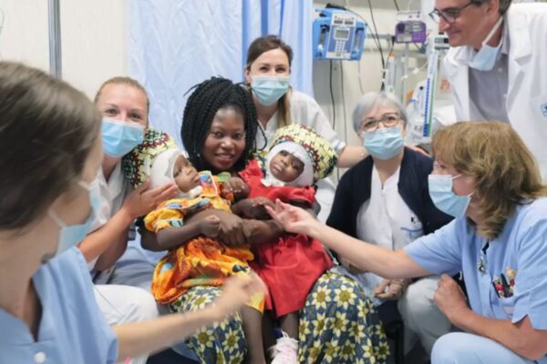 Separate due gemelline siamesi unite dalla testa, primo intervento al mondo al Bambin Gesù di Roma