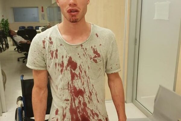 “Un poliziotto in borghese mi ha pestato”, l’accusa di un giovanissimo