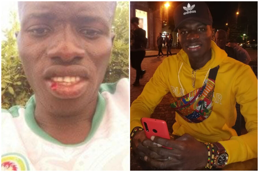 Picchiato in spiaggia perchè senegalese: il figlio dell’aggressore di 8 anni cerca di fermarlo