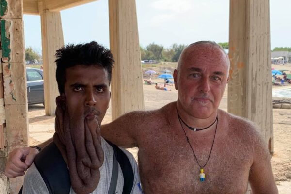 “Aiutiamo Alam”, l’appello per il migrante dal volto sfigurato