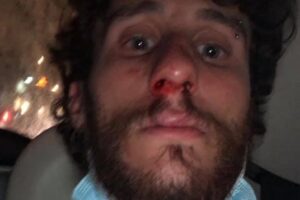 Studente pestato dal branco a piazza Bellini: “Gridavano ‘frocio’, ora ho tanta rabbia”