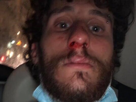 Studente pestato dal branco a piazza Bellini: “Gridavano ‘frocio’, ora ho tanta rabbia”