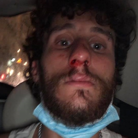 Studente pestato dal branco a piazza Bellini: “Gridavano ‘frocio’, ora ho tanta rabbia”