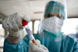 Foto Claudio Furlan – LaPresse 
08 Aprile 2020 Milano (Italia) 
News
Servizio di tamponi covid direttamente dall’auto per pazienti dimessi, all’Ospedale Bassini di Cinisello Balsamo

Photo Claudio Furlan/Lapresse
08 Aprile 2020 Milano (Italy)
Service of covid swabs directly from the car for discharged patients, at the Bassini Hospital in Cinisello Balsamo