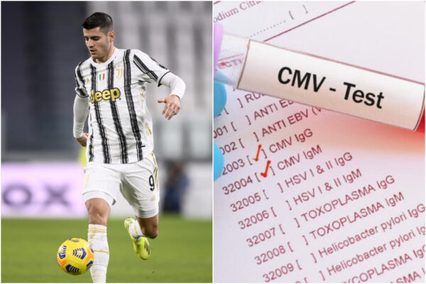 Cos’è il citomegalovirus e come si contrae l’infezione che ha colpito Morata