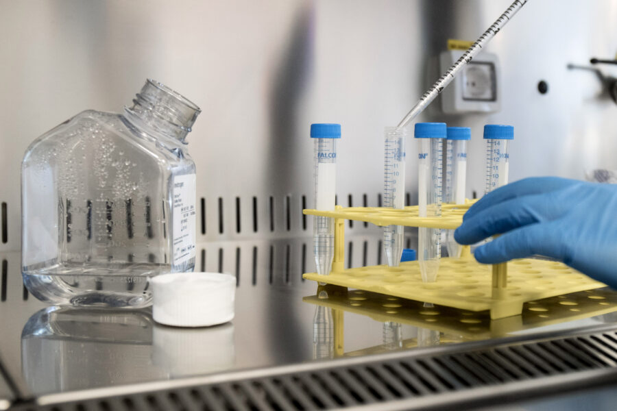 Scoperto in Italia enzima che favorisce la diffusione del virus: “Via alla sperimentazione di un farmaco”