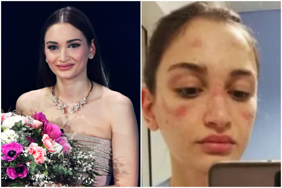 Alessia Bonari, l’omaggio del Festival di Sanremo all’infermiera: “Sei il simbolo della lotta al covid”