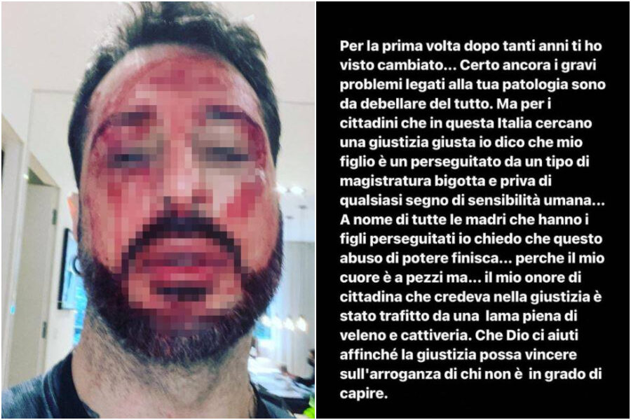 Fabrizio Corona torna in carcere, sui social il volto pieno di sangue e la minaccia ai magistrati: “Avete creato un mostro”