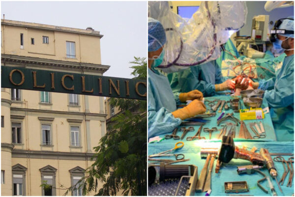 Napoli, ricostruito avambraccio a un uomo grazie a ossa da cadavere e cellule staminali