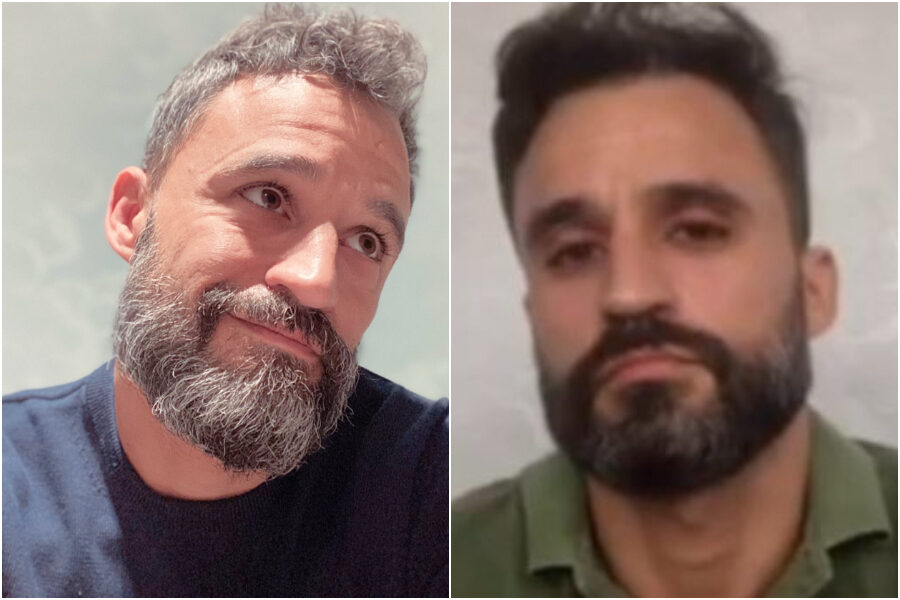 Un anno in terapia intensiva Covid, i segni su un infermiere: “Così sono invecchiato lavorando in ospedale”