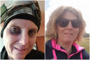 Rifiuta prelievo per salvare la figlia malata e abbandonata alla nascita: “Condanna a morte”