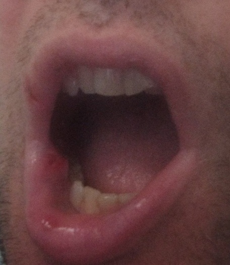 Aggredito nella metro C di Roma: verificatore in ospedale