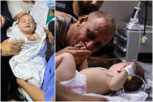 Il piccolo Omar, unico superstite al bombardamento che ha ucciso intera famiglia