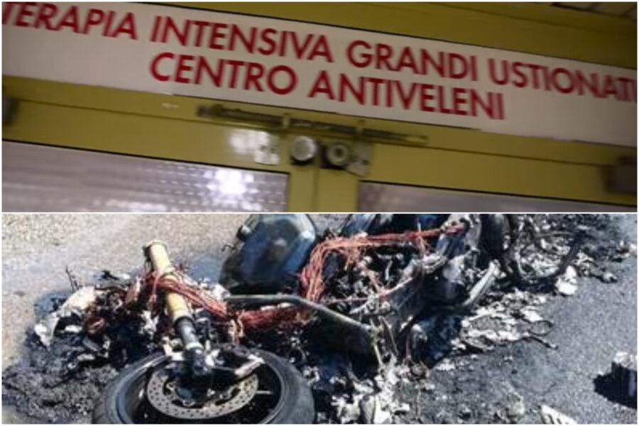 Moto in fiamme, il15enne Christian lotta tra la vita e la morte: ha ustioni sul 50% del corpo