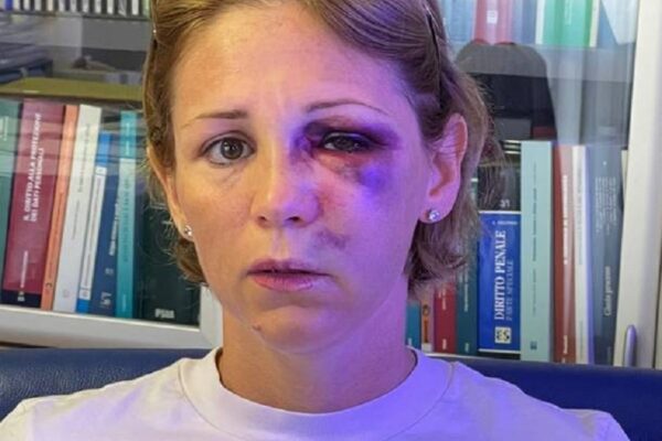 “Come sei carina”, Nicoletta presa a calci e pugni nel supermercato: braccata tra le corsie da un violento