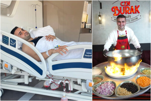 Czn Burak operato, lo chef turco fa preoccupare i fan: “Mi sono sottoposto ad un intervento, grazie a tutti”