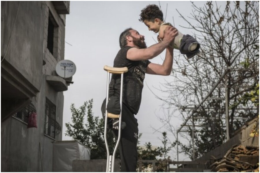 La storia di Mustafa, il bimbo siriano senza braccia e gambe: “Sorride sempre ma qui nessuno ci aiuta”