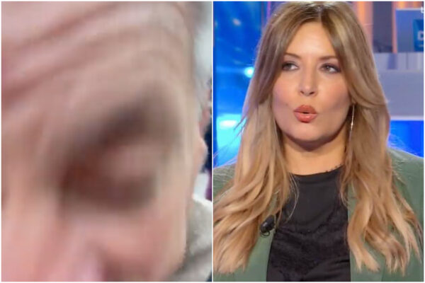 Selvaggia Lucarelli aggredita da no vax (testata al telefono) accusa la polizia: “Assenti, stavano fuori”