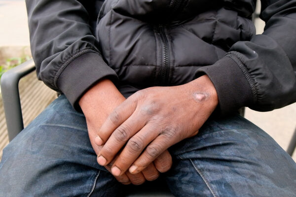 Voleva un contratto, riceve minacce di morte: “Negro, ti ammazzo” Voleva un contratto, riceve minacce di morte: “Negro, ti ammazzo”