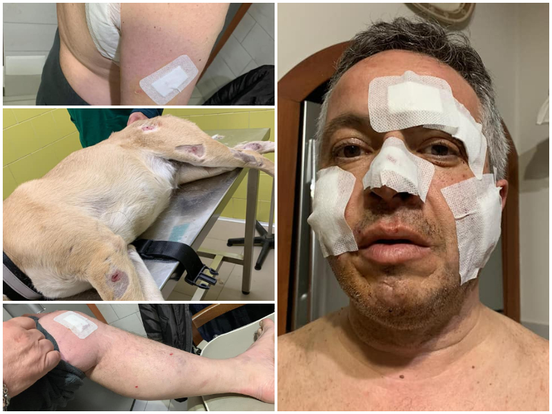 Aggredito da cani in strada, morso e ferito anche in faccia e sulle spalle: “Non è la prima volta”