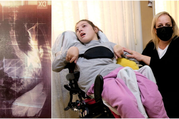 “Arianna ha la schiena a forma di ‘S’, ha bisogno di cure ma del risarcimento nessuna notizia”, la rabbia della famiglia