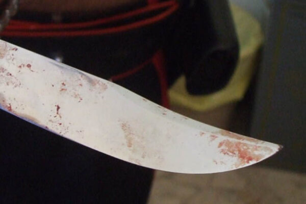 Ferita dal marito con una spada, donna in gravissime condizioni in ospedale