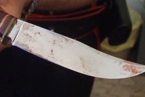 Dodicenne sfregiata a vita in volto col coltello, l’ex fidanzato: “Non volevo ucciderla”