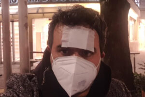 Docente sgrida classe, pestato a sangue sotto casa: “5 persone, a volto coperto: per fortuna non erano armati”