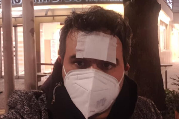 Docente sgrida classe, pestato a sangue sotto casa: “5 persone, a volto coperto: per fortuna non erano armati”