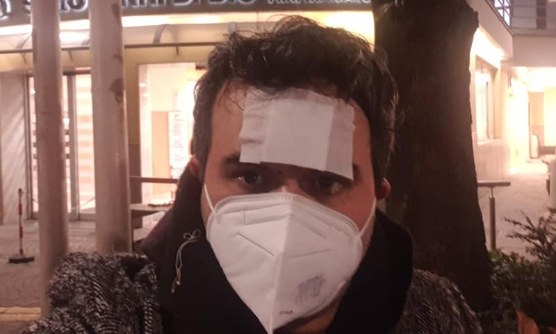 Docente sgrida classe, pestato a sangue sotto casa: “5 persone, a volto coperto: per fortuna non erano armati”